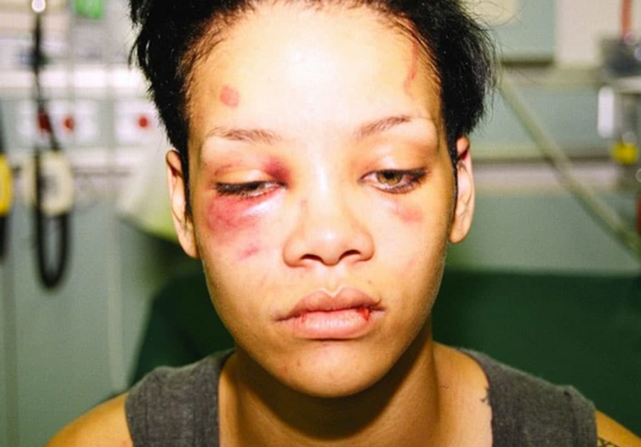 Rihanna fue objeto de una golpiza en 2009
