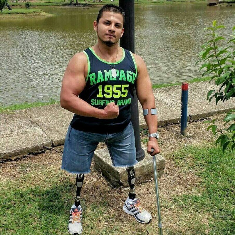 Randy salió del coma para ser hoy el mejor fisiculturista