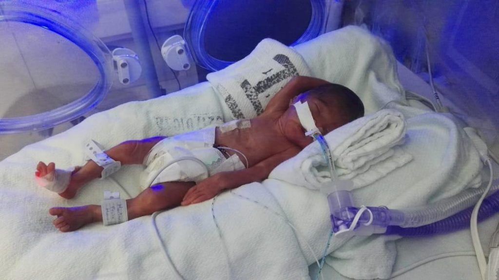 Gael nació a los 5 meses en una ambulancia con menos que lo básico