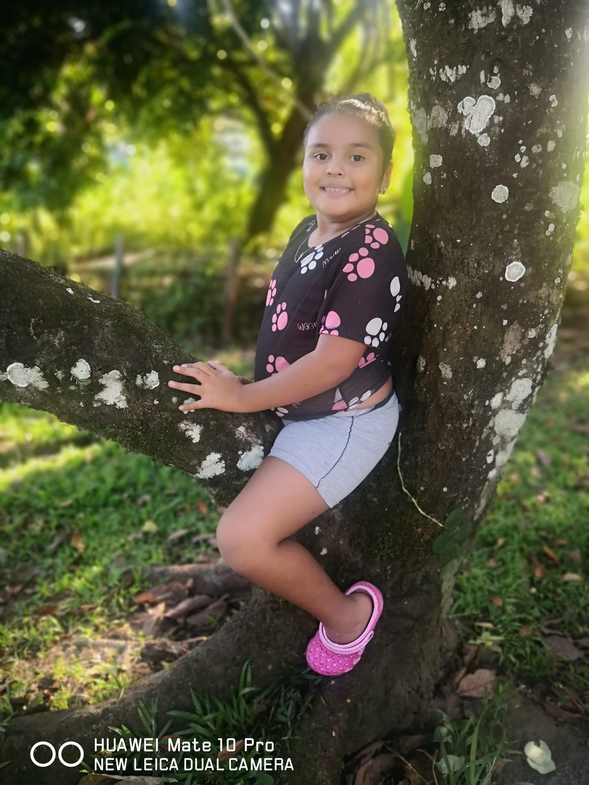 Hoy Sofia tiene 8 años y goza de excelente salud