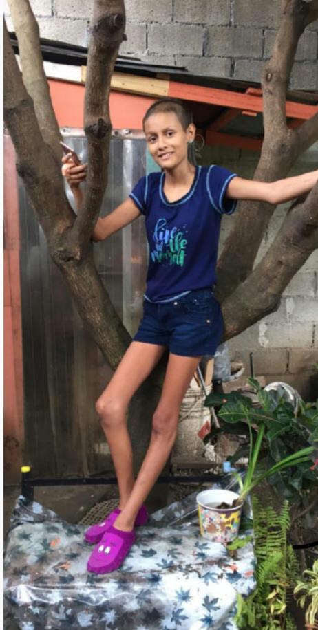 Alanis llegó a pesar 32 kilos