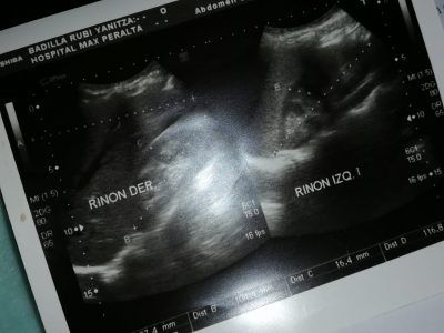 Este ultrasonido se lo realizaron a Andrea para ver problemas en los riñones