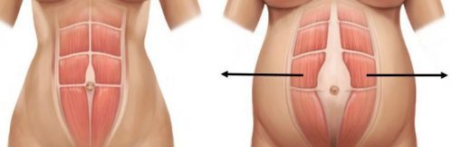 Lo que sucede con el abdomen durante y luego del embarazo