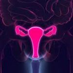 Ataque al cáncer de cérvix