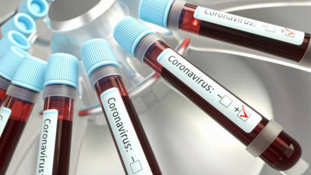 Una pareja en Pavas enfrenta el dolor del coronavirus