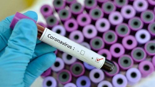 Coronavirus, caso por cantón en CR