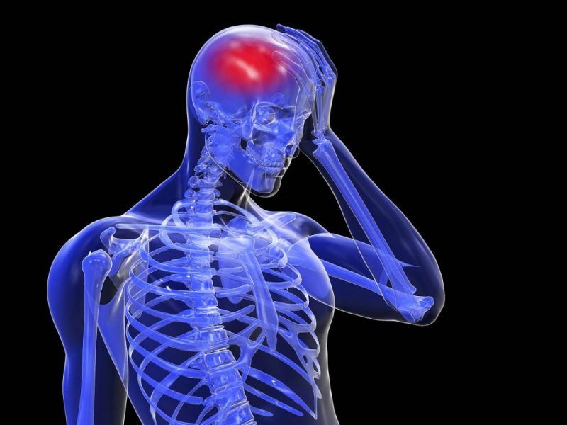 ¿Qué síntomas da un infarto cerebral?