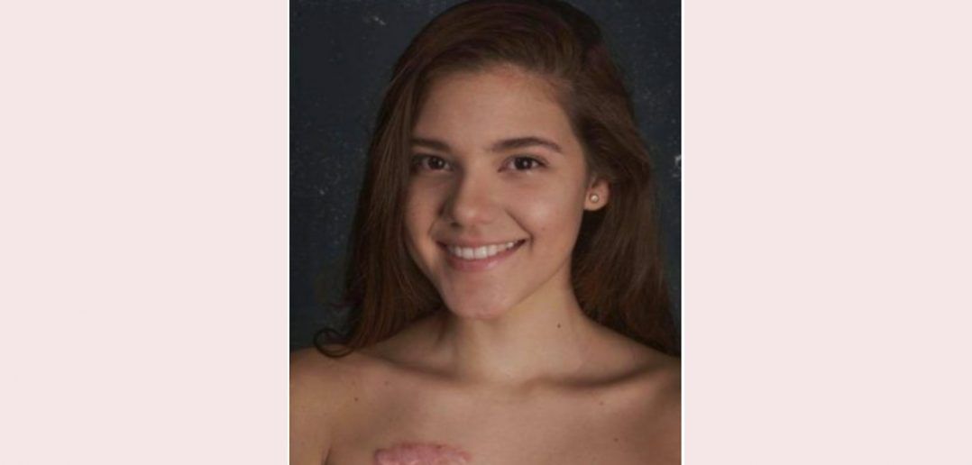 Minoshka Solís tuvo cáncer a los 16 años