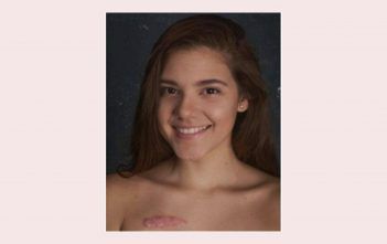Minoshka Solís tuvo cáncer a los 16 años