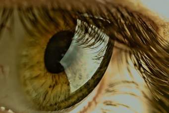 En ASEMBIS trabaja una especialista en prótesis oculares y un neurólogo